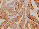 IkB alpha Antibody in Immunohistochemistry (Paraffin) (IHC (P))