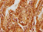 FOXO3A Antibody in Immunohistochemistry (Paraffin) (IHC (P))