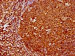 FOXO3A Antibody in Immunohistochemistry (Paraffin) (IHC (P))