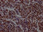 LSD1 Antibody in Immunohistochemistry (Paraffin) (IHC (P))