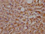 LDLR Antibody in Immunohistochemistry (Paraffin) (IHC (P))