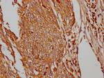 GLUT1 Antibody in Immunohistochemistry (Paraffin) (IHC (P))