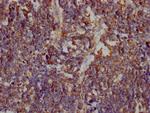 GLUT1 Antibody in Immunohistochemistry (Paraffin) (IHC (P))