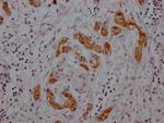 Midkine Antibody in Immunohistochemistry (Paraffin) (IHC (P))