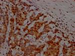 ATM Antibody in Immunohistochemistry (Paraffin) (IHC (P))