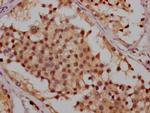 ATM Antibody in Immunohistochemistry (Paraffin) (IHC (P))