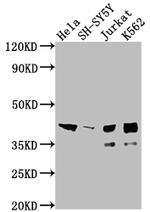 ISL1 Antibody in Western Blot (WB)