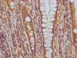 CD51 Antibody in Immunohistochemistry (Paraffin) (IHC (P))