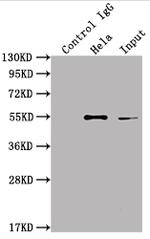 ILK Antibody in Immunoprecipitation (IP)