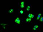 PKM2 Antibody in Immunocytochemistry (ICC/IF)