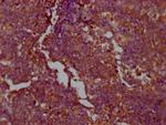 PKM2 Antibody in Immunohistochemistry (Paraffin) (IHC (P))