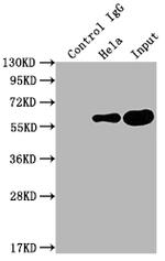 PKM2 Antibody in Immunoprecipitation (IP)