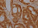 EZH2 Antibody in Immunohistochemistry (Paraffin) (IHC (P))