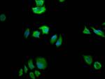 FASN Antibody in Immunocytochemistry (ICC/IF)