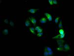 CXCR4 Antibody in Immunocytochemistry (ICC/IF)