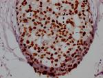 FOXA1 Antibody in Immunohistochemistry (Paraffin) (IHC (P))