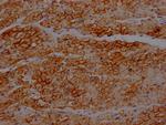 Dystrophin Antibody in Immunohistochemistry (Paraffin) (IHC (P))