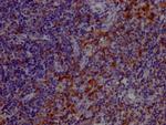TLR7 Antibody in Immunohistochemistry (Paraffin) (IHC (P))