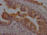 CD26 Antibody in Immunohistochemistry (Paraffin) (IHC (P))