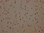 PARP1 Antibody in Immunohistochemistry (Paraffin) (IHC (P))