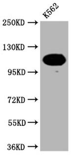 PARP1 Antibody in Western Blot (WB)