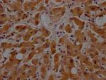 ApoC3 Antibody in Immunohistochemistry (Paraffin) (IHC (P))