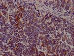 JAK3 Antibody in Immunohistochemistry (Paraffin) (IHC (P))