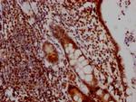 DDX5 Antibody in Immunohistochemistry (Paraffin) (IHC (P))