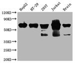 DDX5 Antibody in Western Blot (WB)