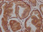 LOXL2 Antibody in Immunohistochemistry (Paraffin) (IHC (P))