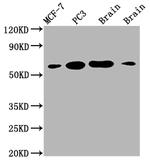 LOXL2 Antibody in Western Blot (WB)