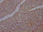 UQCRC2 Antibody in Immunohistochemistry (Paraffin) (IHC (P))