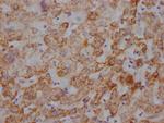 UQCRC2 Antibody in Immunohistochemistry (Paraffin) (IHC (P))