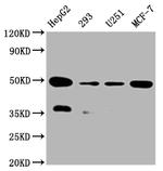 UQCRC2 Antibody in Western Blot (WB)