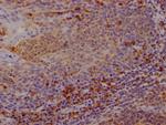 CTLA-4 Antibody in Immunohistochemistry (Paraffin) (IHC (P))