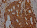 Aldolase A Antibody in Immunohistochemistry (Paraffin) (IHC (P))