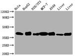 Aldolase A Antibody in Western Blot (WB)