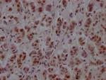 PTBP1 Antibody in Immunohistochemistry (Paraffin) (IHC (P))