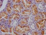 Cathepsin S Antibody in Immunohistochemistry (Paraffin) (IHC (P))