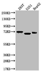 SLC6A4 Antibody in Western Blot (WB)