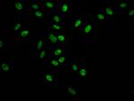 SF3B1 Antibody in Immunocytochemistry (ICC/IF)