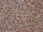 SF3B1 Antibody in Immunohistochemistry (Paraffin) (IHC (P))