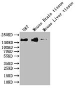 SF3B1 Antibody in Western Blot (WB)