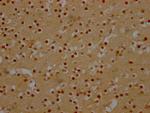 DDX6 Antibody in Immunohistochemistry (Paraffin) (IHC (P))