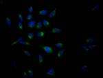 Amyloid Precursor Protein Antibody in Immunocytochemistry (ICC/IF)