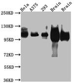 Amyloid Precursor Protein Antibody in Western Blot (WB)