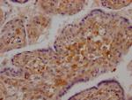 RIG-I Antibody in Immunohistochemistry (Paraffin) (IHC (P))