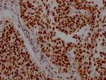 ILF3 Antibody in Immunohistochemistry (Paraffin) (IHC (P))