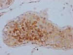 TACC3 Antibody in Immunohistochemistry (Paraffin) (IHC (P))