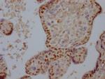 DNMT1 Antibody in Immunohistochemistry (Paraffin) (IHC (P))